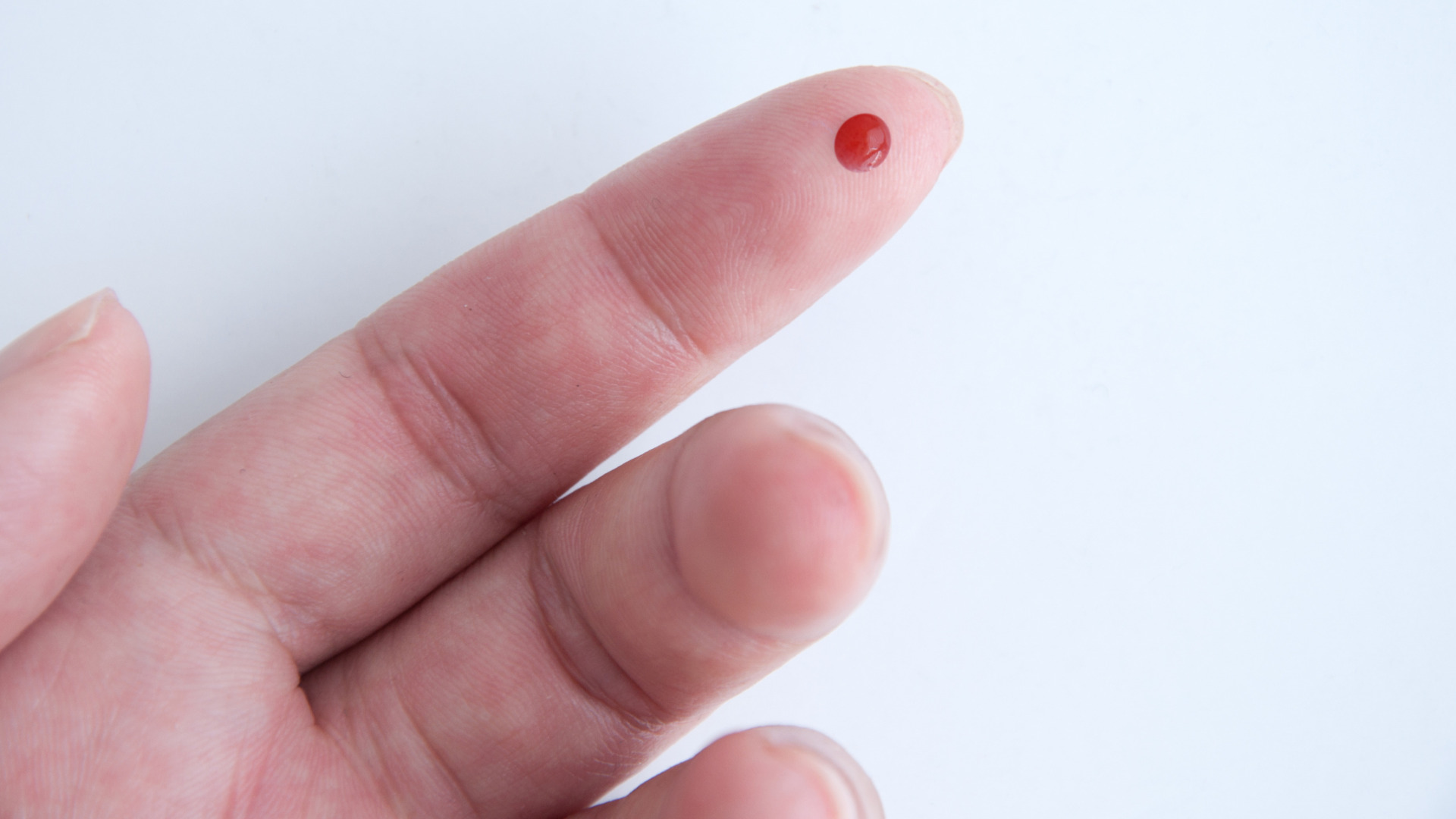 Phú Thọ: nam bệnh nhân nguy kịch do chích lể máu đầu ngón tay chữa đột quỵ