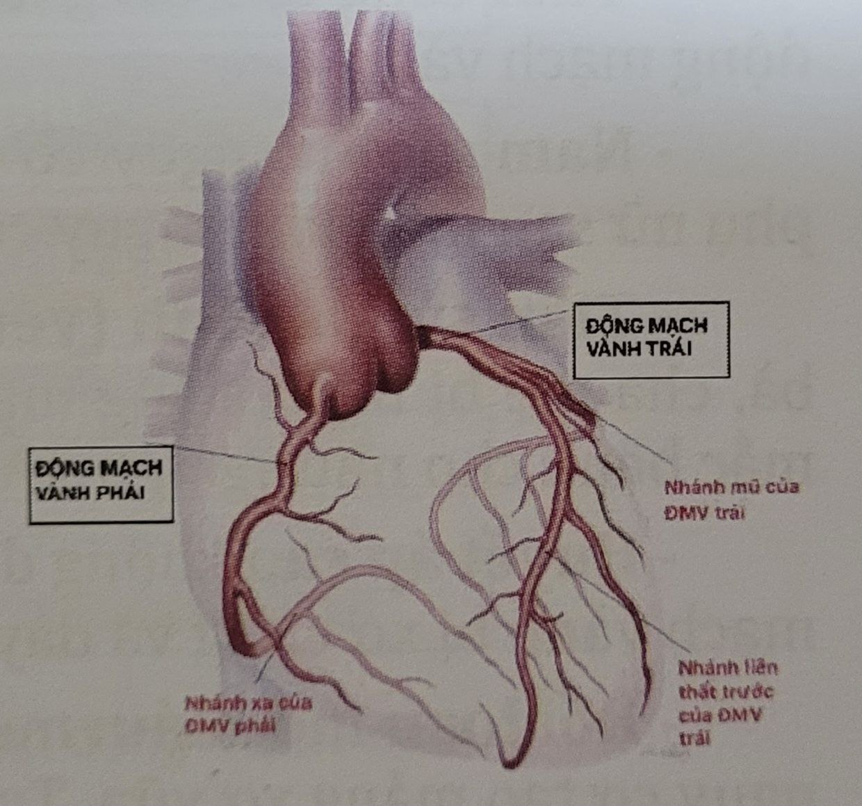 Thiếu máu cơ tim – Bệnh động mạch vành