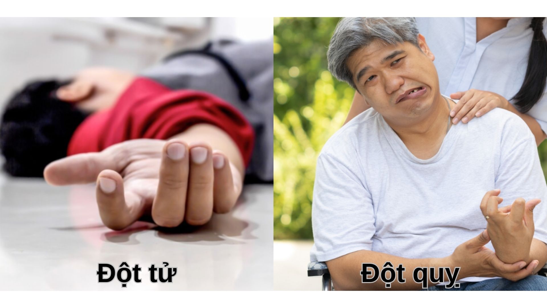 Phân biệt và hướng xử trí khi bị đột quỵ, đột tử ra sao?