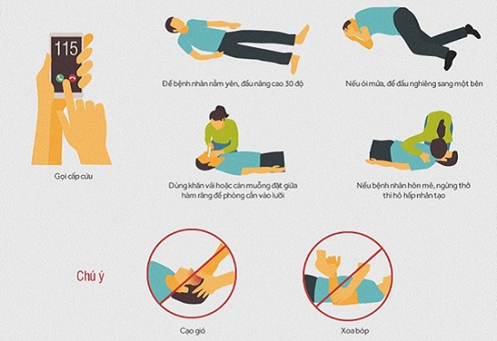 Hướng dẫn cấp cứu bệnh nhân đột quỵ ngoài cộng đồng