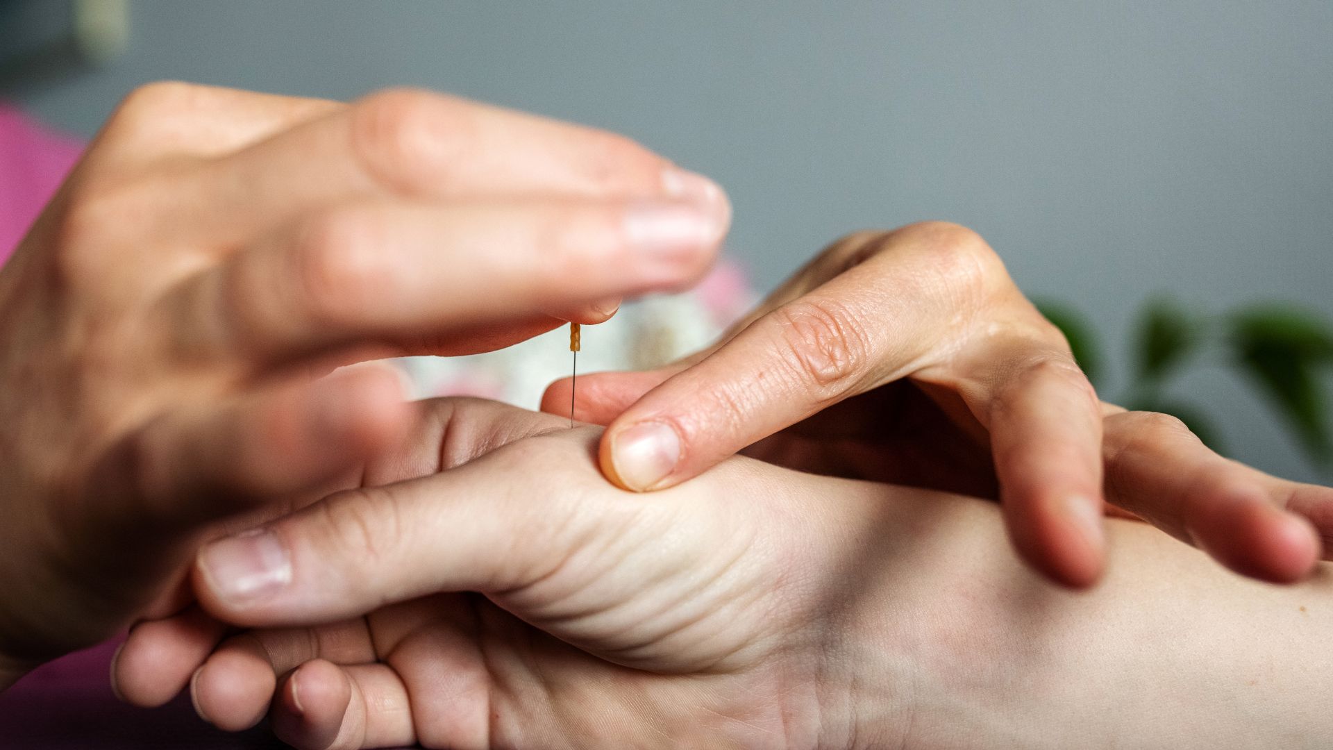 Có được châm cứu, xoa bóp bấm huyệt sau điều trị đột quỵ?