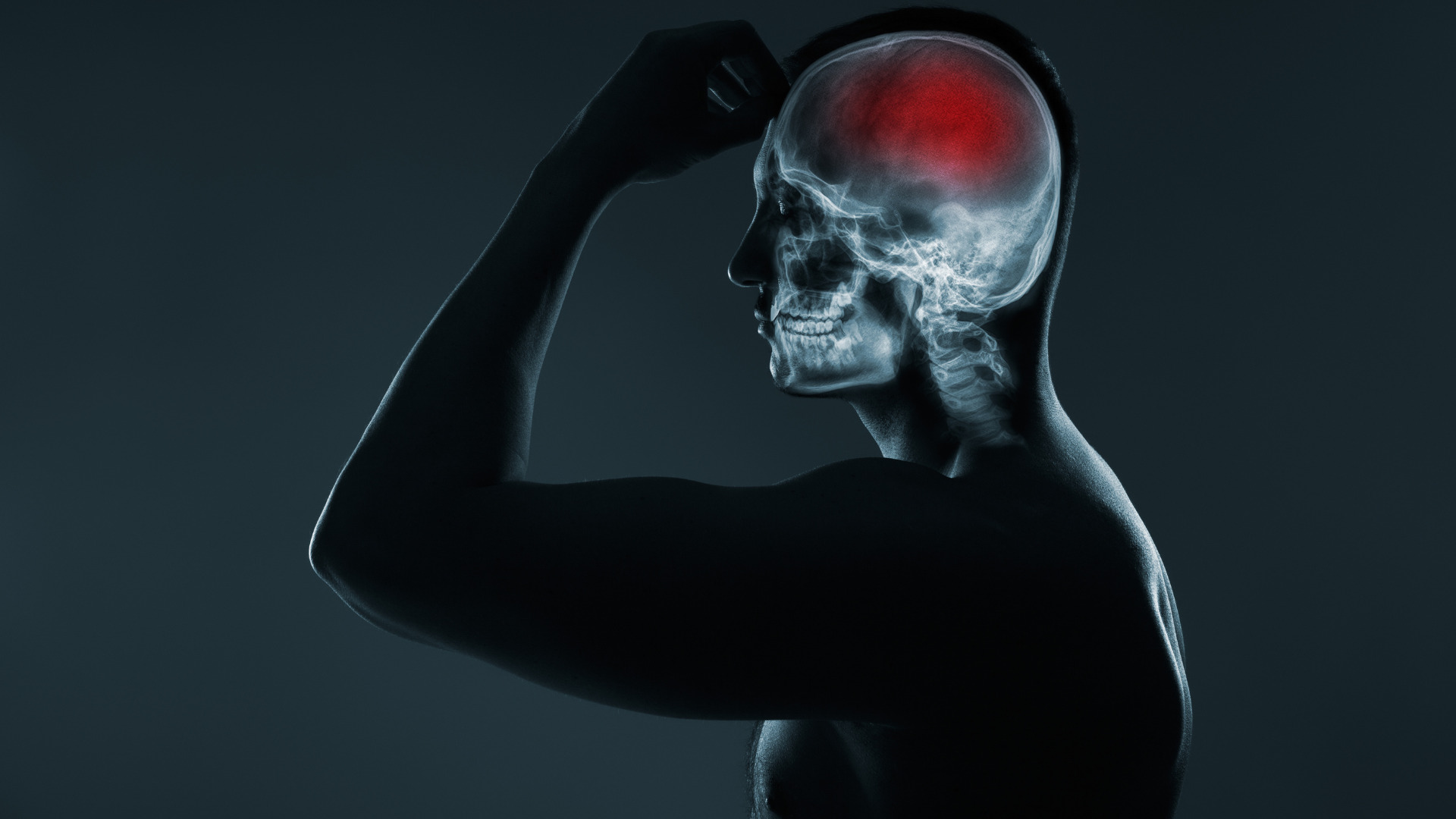 Sau đột quỵ xuất huyết não, liệu bệnh nhân có thể hồi phục?