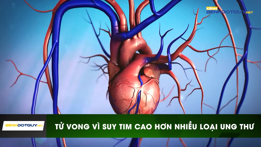 Tỷ lệ tử vong do suy tim cao hơn nhiều so với ung thư
