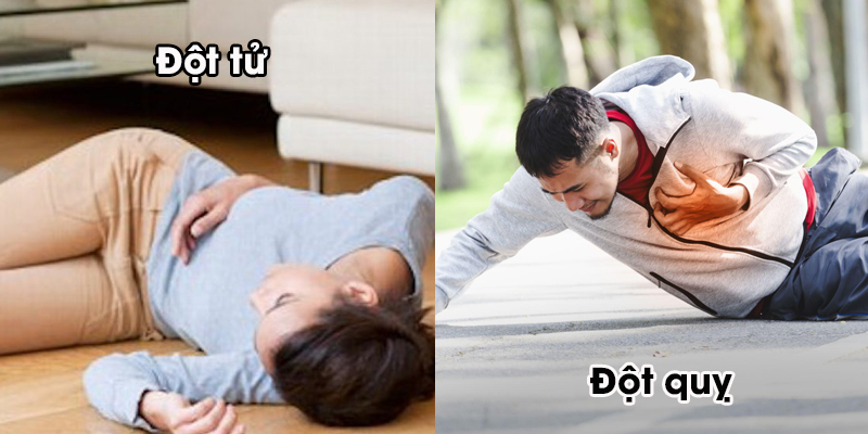 Nhận biết dáu hiệu và hướng xử trí khi bị đột quỵ, đột tử