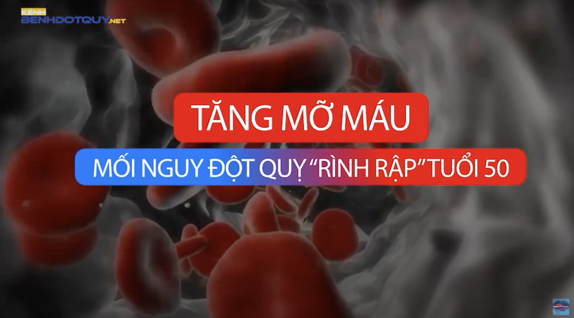 Tăng mỡ máu – Mối nguy đột quỵ “rình rập” tuổi trung niên