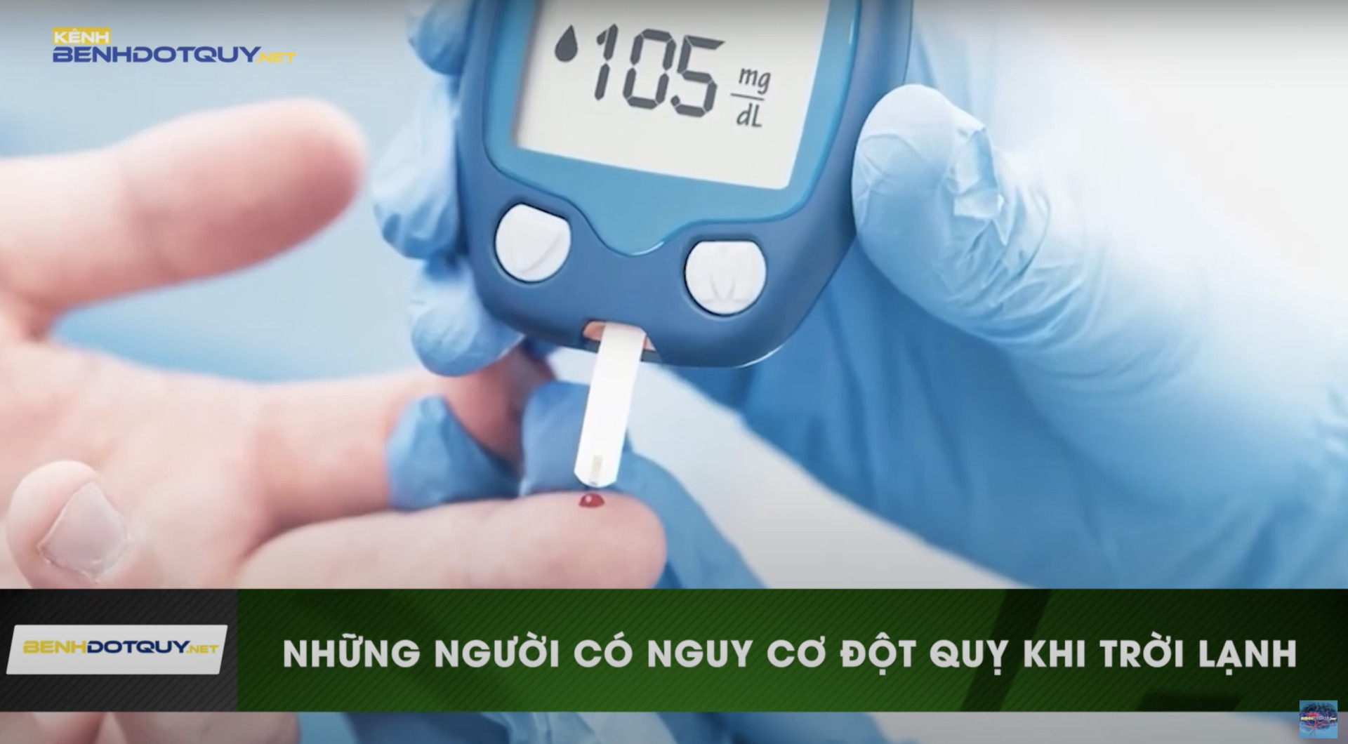 Cảnh báo những người có nguy cơ cao đột quỵ khi trời trở lạnh