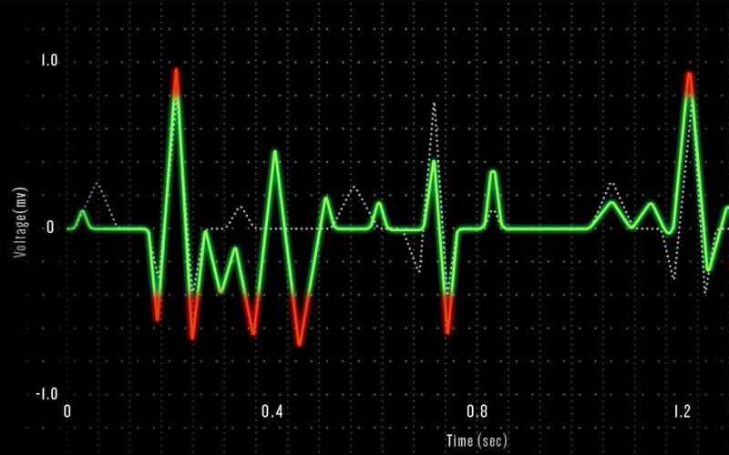 Nhịp tim nhannh 150 lần/phút, liệu có bất thường
