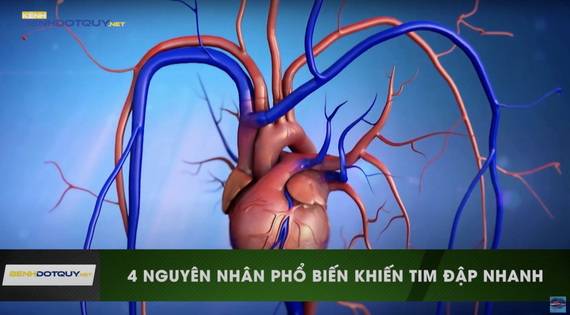Tim đập nhanh do 4 nguyên nhân phổ biến sau