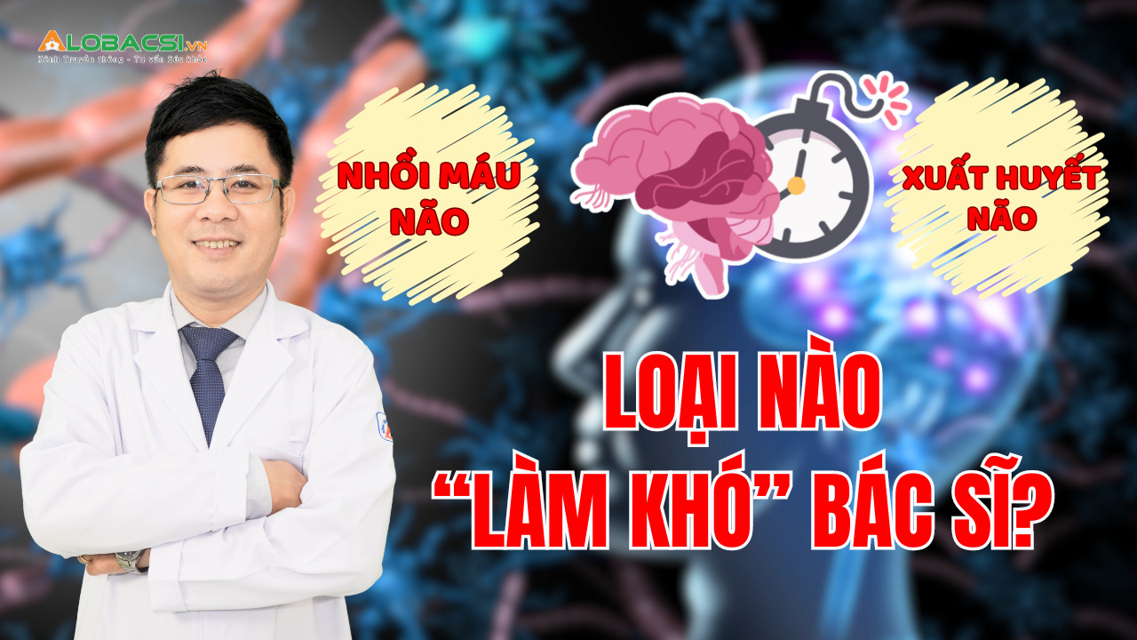 Nhồi máu não và xuất huyết não, tình trạng nào “làm khó” bác sĩ đột quỵ nhiều hơn?