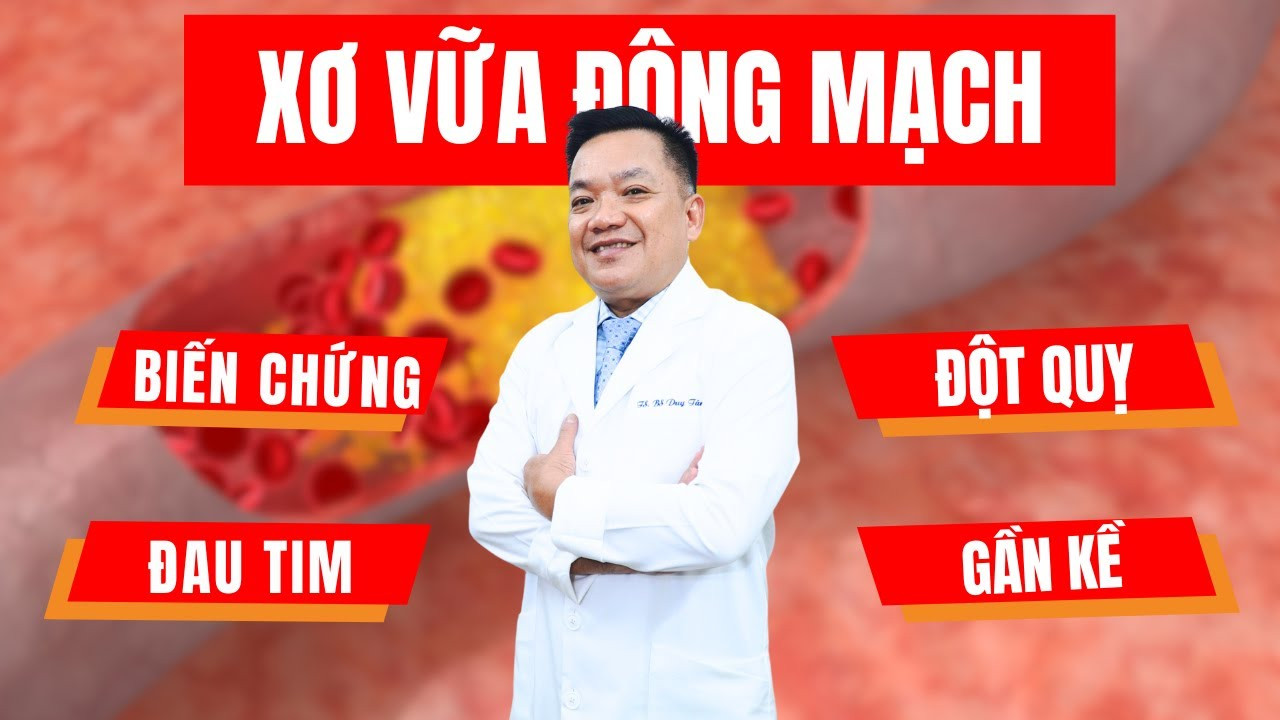 Xơ vữa động mạch – Biến chứng đau tim, đột quỵ gần kề