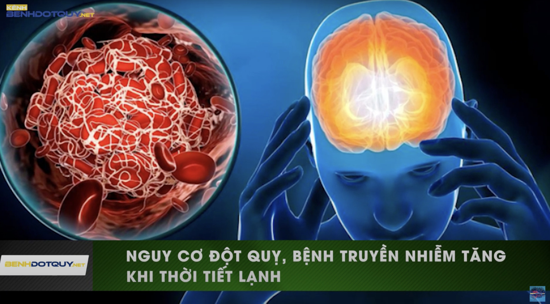 Thời tiết trở lạnh làm tăng nguy cơ đột quỵ, bệnh truyền nhiễm