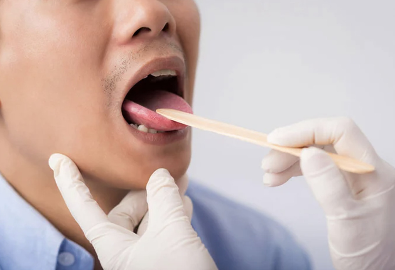 Cảnh báo loạt bệnh ung thư, gan, đột quỵ nguy hiểm qua 5 dấu hiệu ở lưỡi