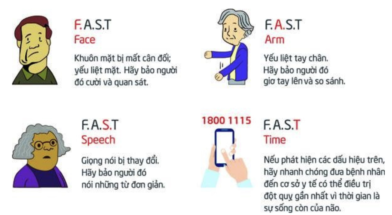 Hơn 300 bệnh nhân đột quỵ cấp cứu tại Bệnh viện Nhân dân 115 trong 1 tuần nghỉ Tết