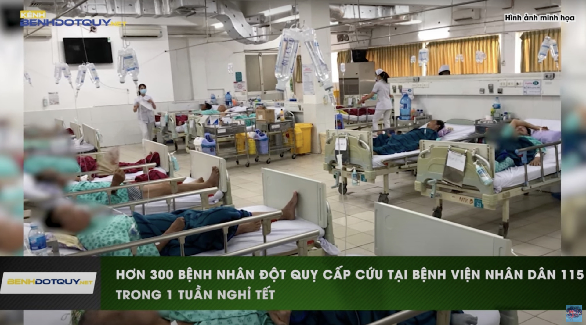 Hơn 300 bệnh nhân đột quỵ cấp cứu tại Bệnh viện Nhân dân 115 trong 1 tuần nghỉ Tết