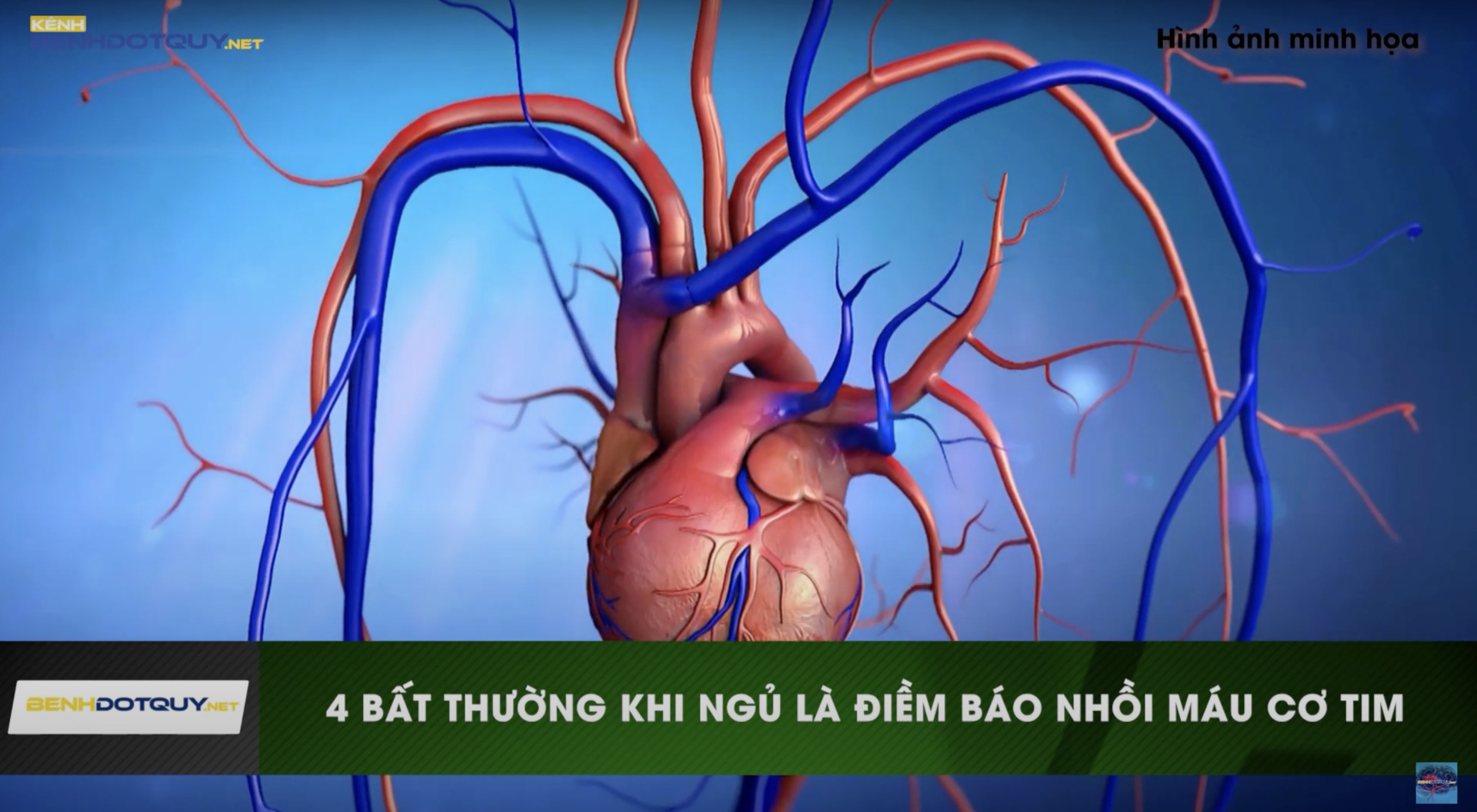 Cần cảnh giác 4 bất thường khi ngủ, có thể là điềm báo nhồi máu cơ tim