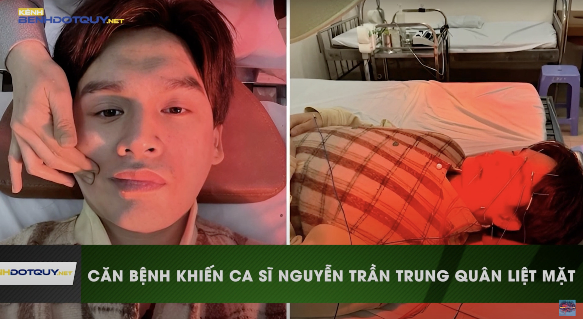 Nguyên nào khiến ca sĩ Nguyễn Trần Trung Quân méo miệng phải nhập viện?