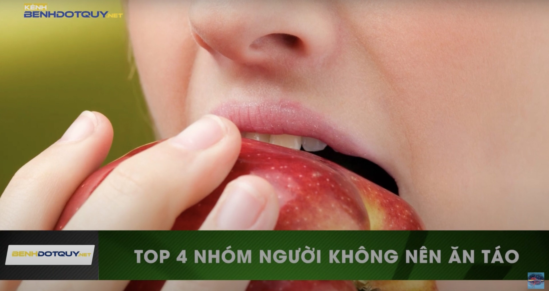 Táo là một loại trái cây tốt, nhưng những ai nên hạn chế ăn?