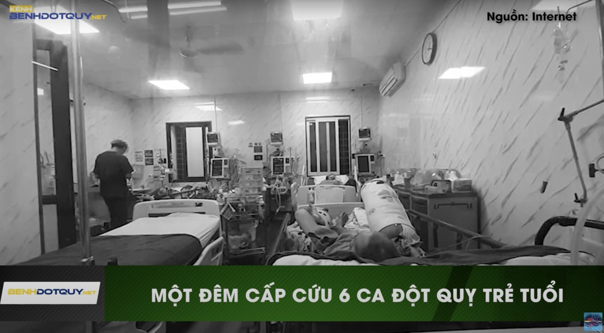 Bệnh viện Bạch Mai liên tiếp cấp cứu 6 trường hợp đột quỵ trẻ tuổi