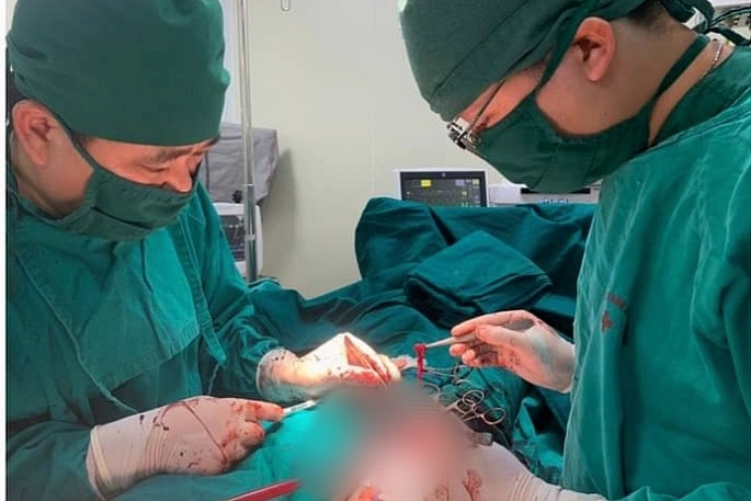 Can thiệp thành công trường hợp tắc động mạch chậu cấp do huyết khối từ tim