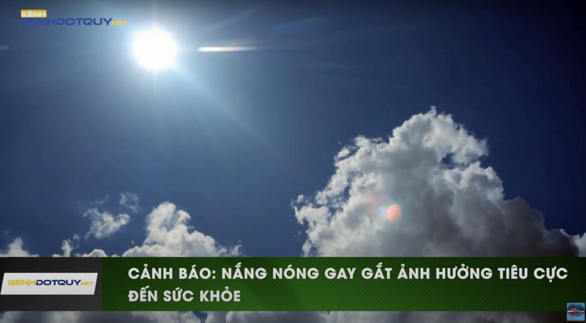 Nắng nóng gay gắt: Cảnh báo ảnh hưởng tiêu cực đến sức khỏe