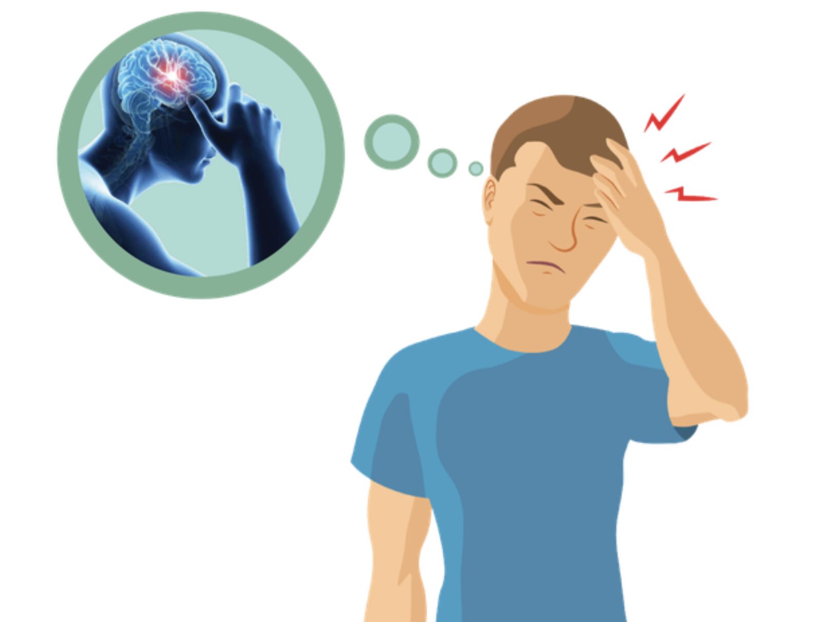 Đau nửa đầu kéo dài không khỏi, liệu có phải triệu chứng của một bệnh lý nguy hiểm?