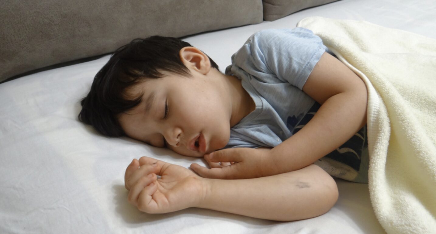 Điều trị hội chứng ngưng thở khi ngủ ở trẻ ở đâu?