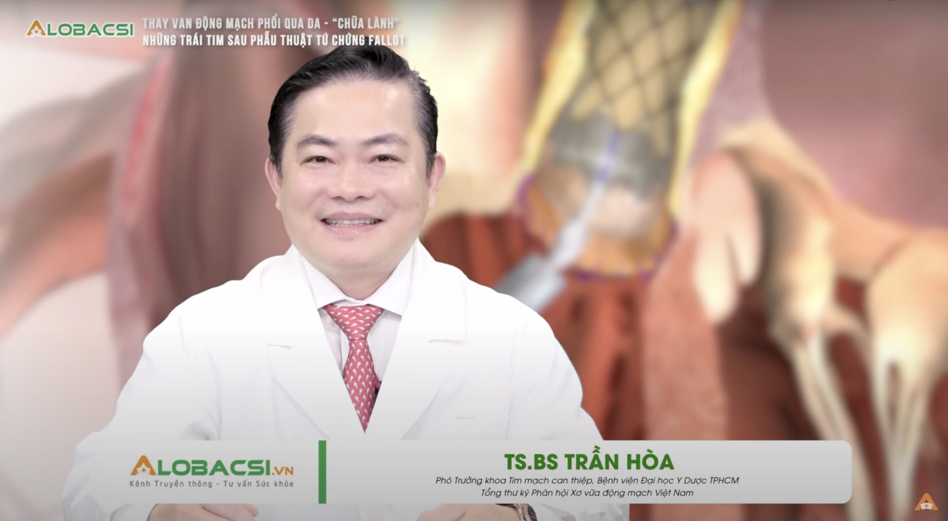 Khoảng 50% trường hợp xuất hiện biến chứng hở van động mạch phổi sau phẫu thuật tứ chứng Fallot