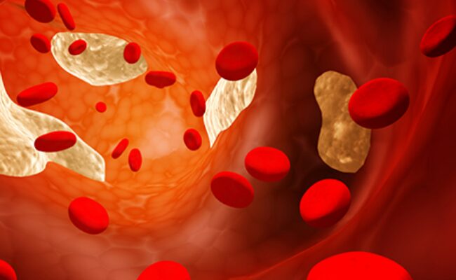 Top 10 loại thực phẩm không nên bỏ qua giúp giảm cholesterol xấu