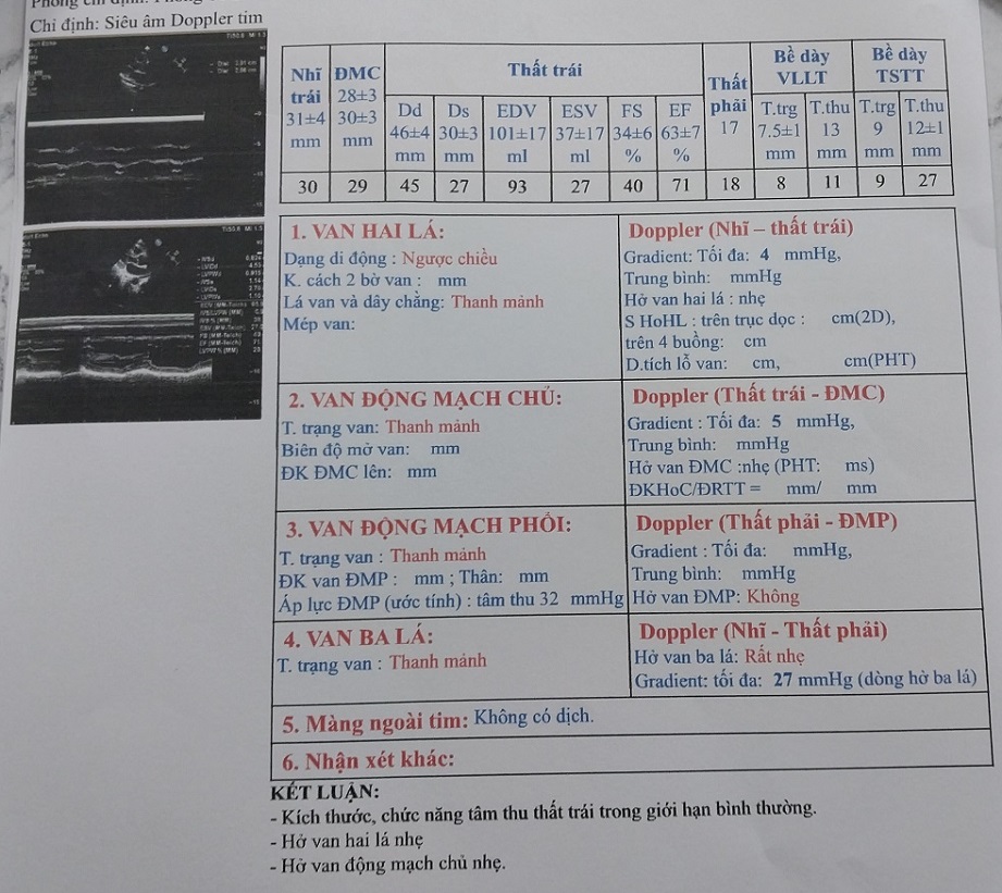 Kết quả siêu âm cho thấy hở van tim 2 lá, là hở van sinh lý hay bệnh lý?