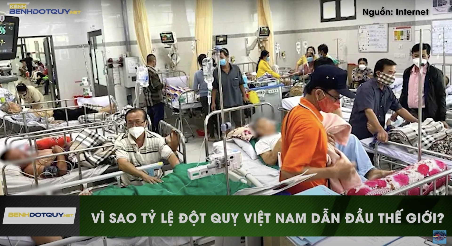 Nguyên nhân nào khiến Việt Nam dẫn đầu thế giới về tỷ lệ đột quỵ?