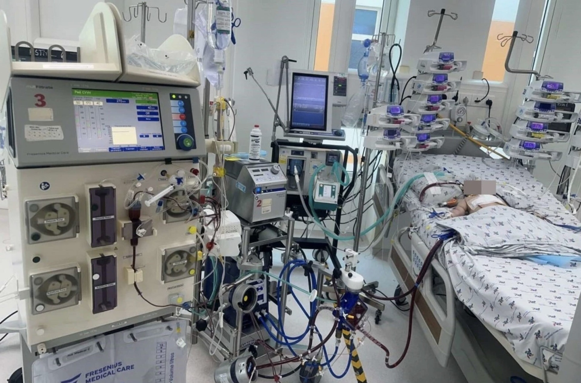 TPHCM: Cứu sống bé gái 7 tháng tuổi bị tim bẩm sinh nặng bằng kỹ thuật ECMO