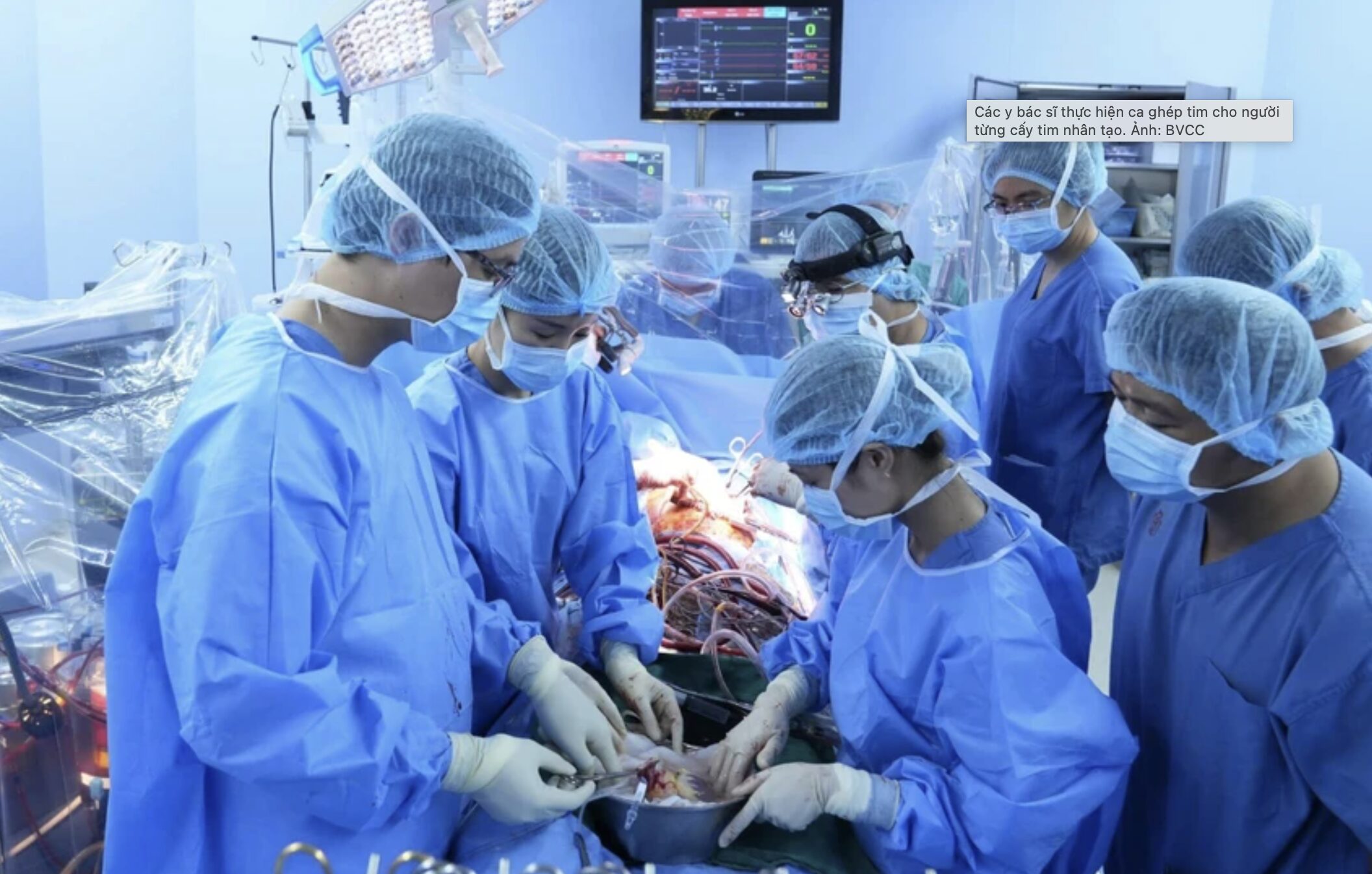 Hà Nội: Ca ghép tim đầu tiên cho bệnh nhân đã cấy dụng cụ hỗ trợ thất trái