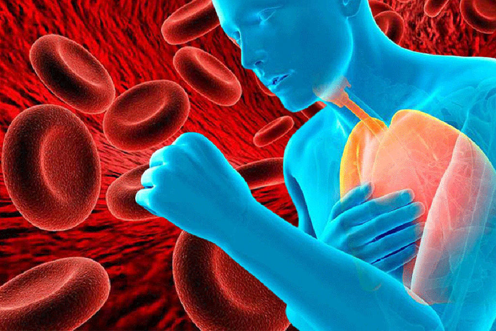 Top những loại thực phẩm tốt người thiếu máu không nên bỏ qua