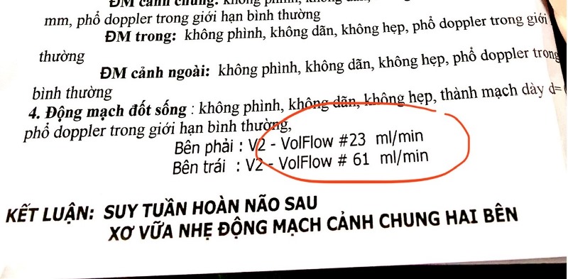Kết quả dòng chảy động mạch đốt sống này cho thấy điều gì?