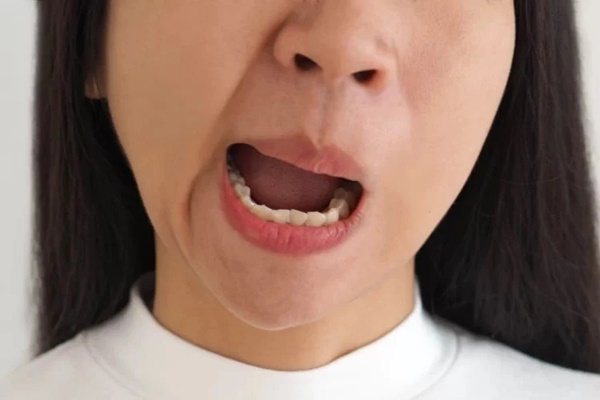 Liệu có bài tập nào cho bệnh nhân méo miệng, nói khó, liệt nửa người có thể tự tập tại nhà không?