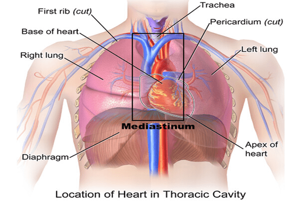Khi nào nên phẫu thuật khi bị u trung thất lành tính?