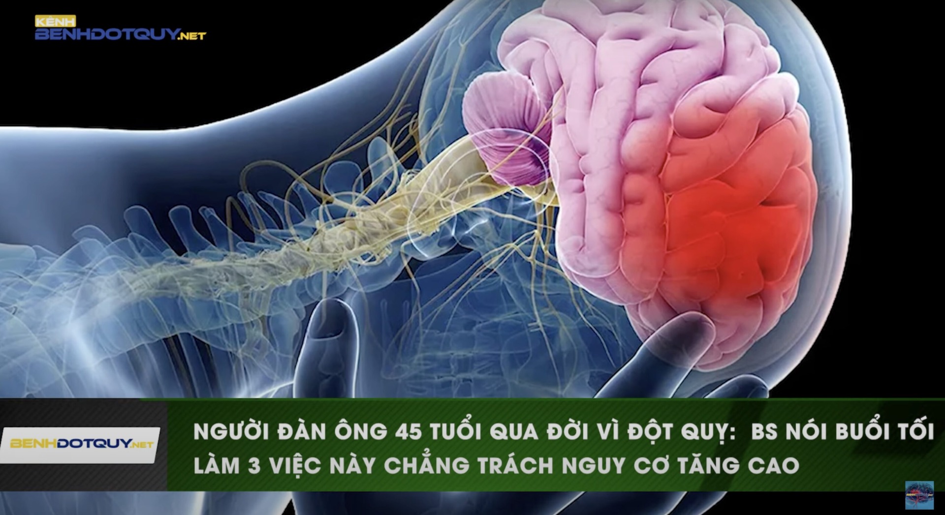 Người đàn ông 45 tuổi bị nhồi máu não lúc nửa đêm vì thường xuyên làm việc này