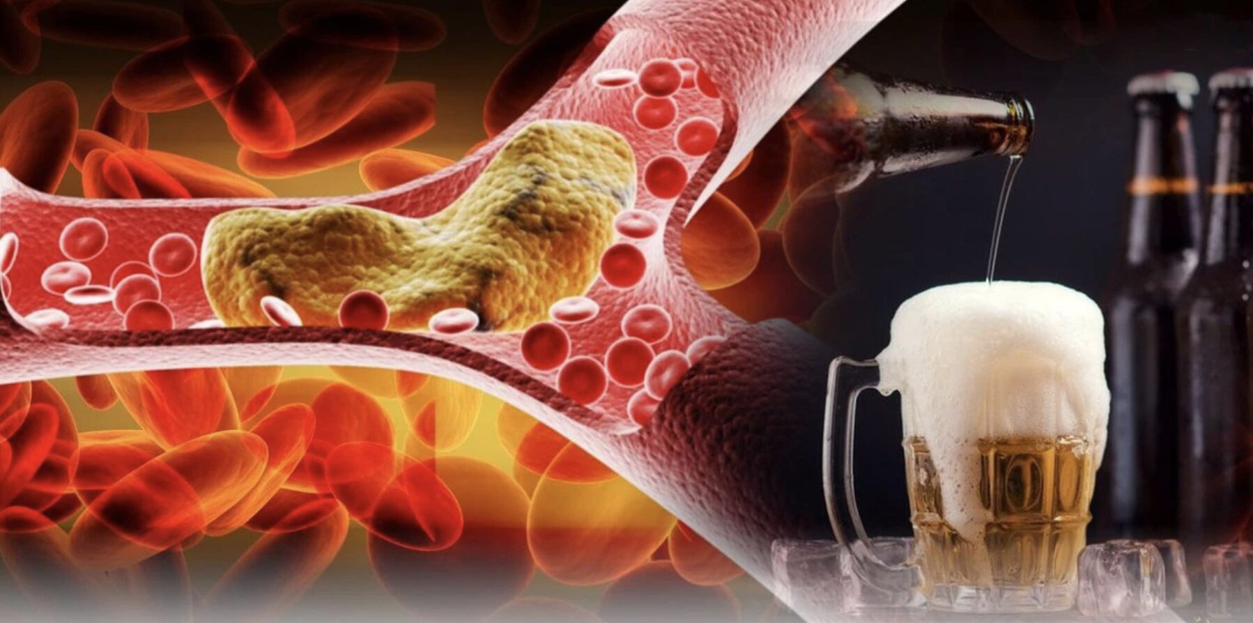 Phú Thọ: Người đàn ông đột quỵ não liệt nửa người do nhiều năm nghiện rượu