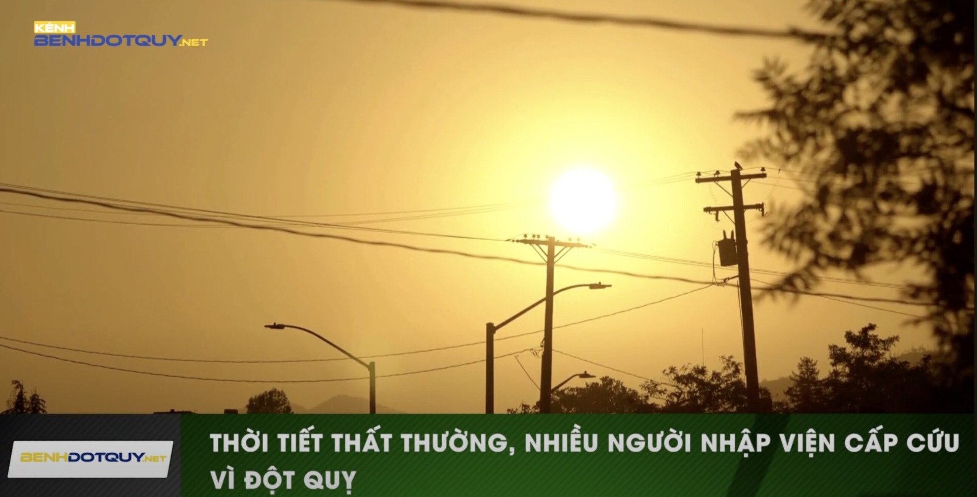 Nhiều người nhập viện cấp cứu do đột quỵ vì thời tiết thay đổi thất thường