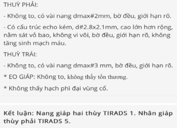 Nhờ bác sĩ xem giúp em kết quả siêu âm tuyến giáp