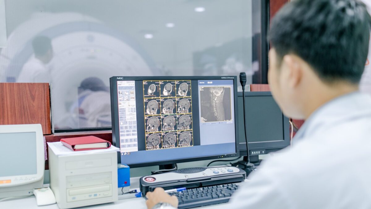 Đột quỵ gây ảnh hưởng nặng nề đến hệ thống thần kinh của não bộ, cần chủ động tầm soát để phòng ngừa ảnh hưởng xấu đến sức khỏe