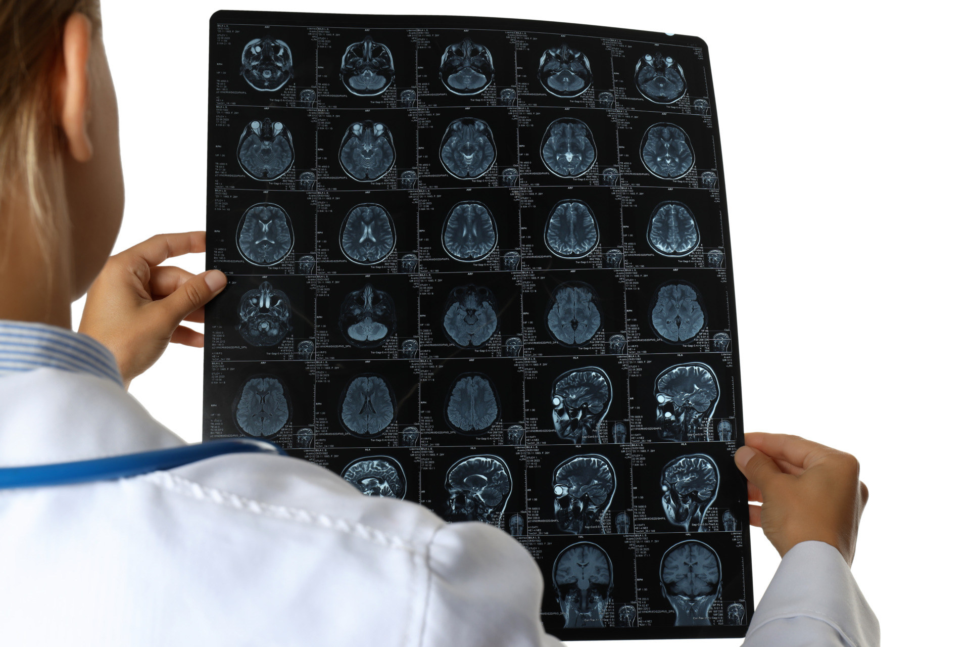 Chi phí gói tầm soát đột quỵ não tại Bệnh viện Trường Đại học Y Dược Cần Thơ là bao nhiêu?