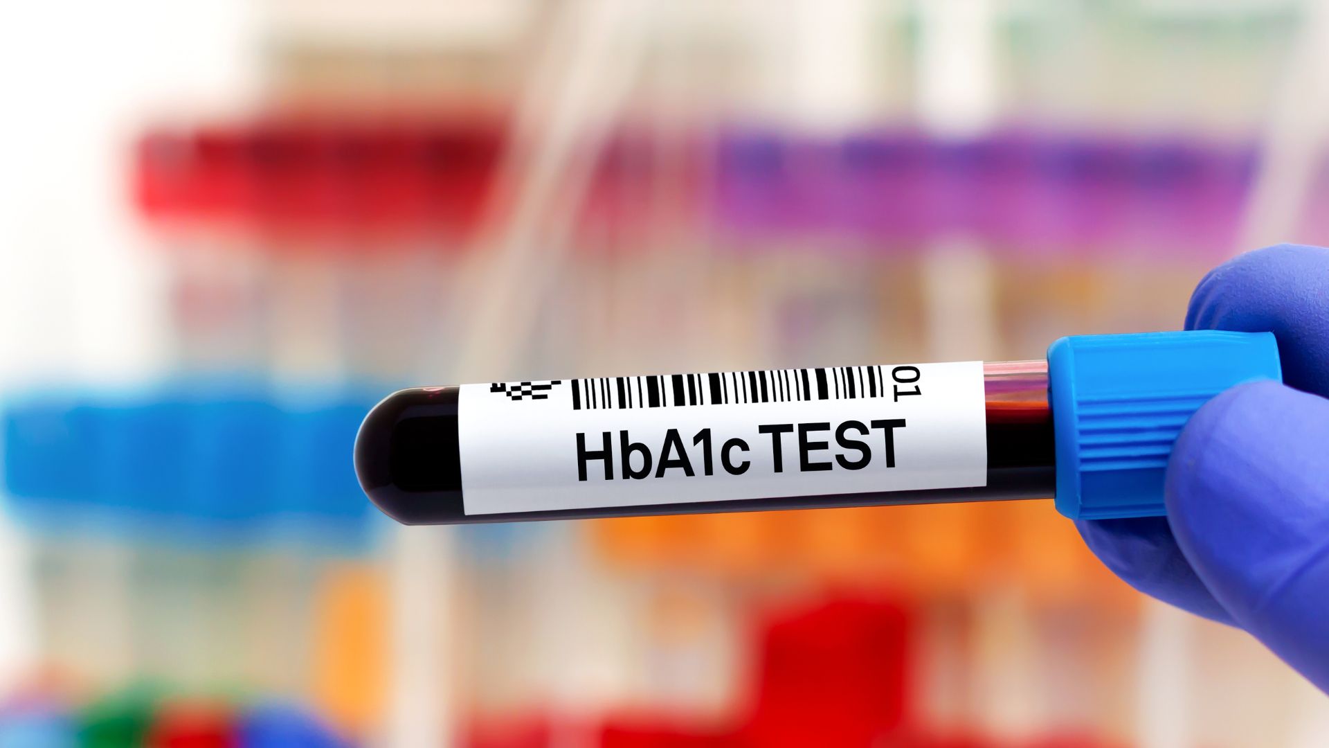 Tầm soát biến chứng bệnh tiểu đường ở bệnh viện nào và chi phí hết bao nhiêu?