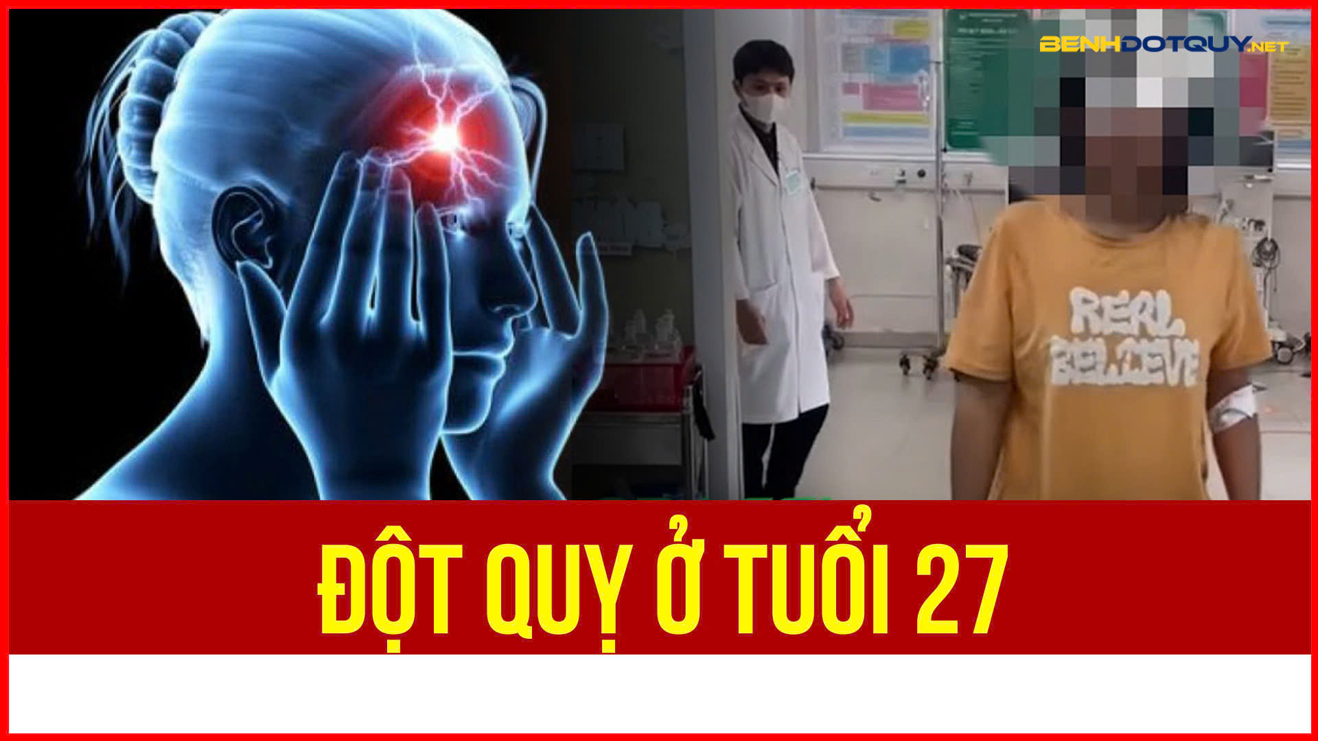 Đột quỵ ở tuổi 27