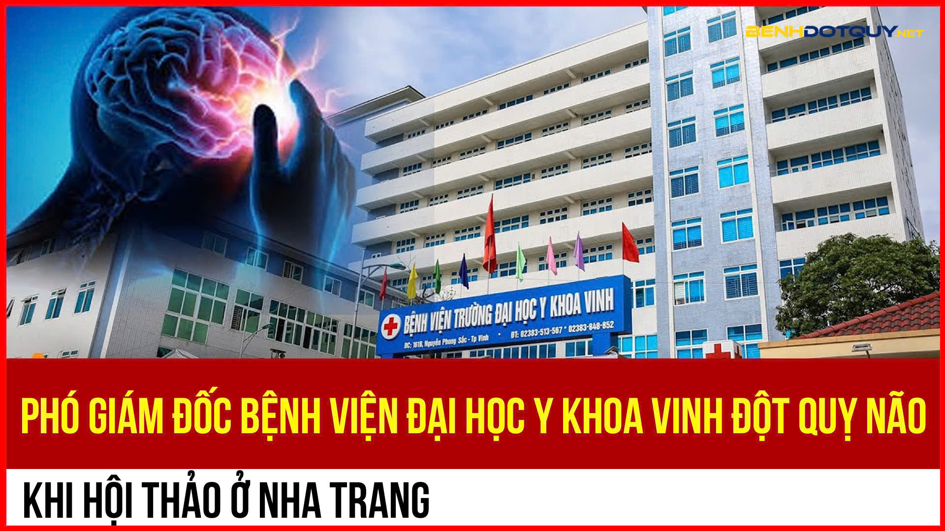 Đang dự hội thảo ở Nha Trang, Phó Giám đốc Bệnh viện Đại học Y khoa Vinh bất ngờ đột quỵ xuất huyết não