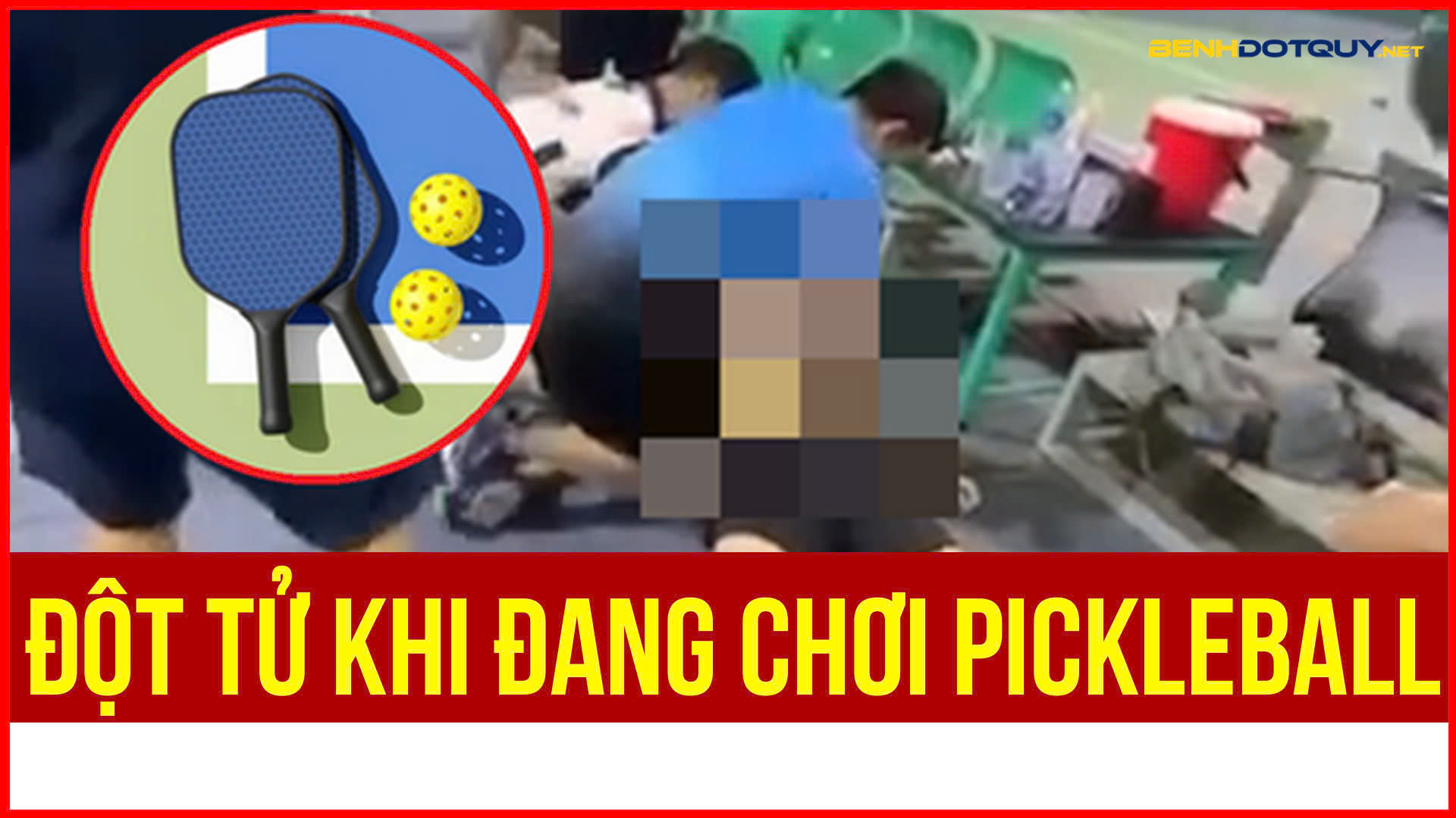 Người đàn ông 39 tuổi đột tử sau khi chơi pickleball