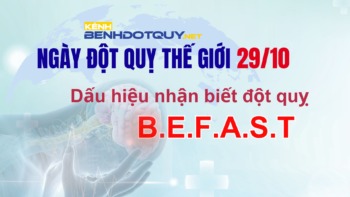 Dấu hiệu nhận biết đột quỵ B.E.F.A.S.T<
