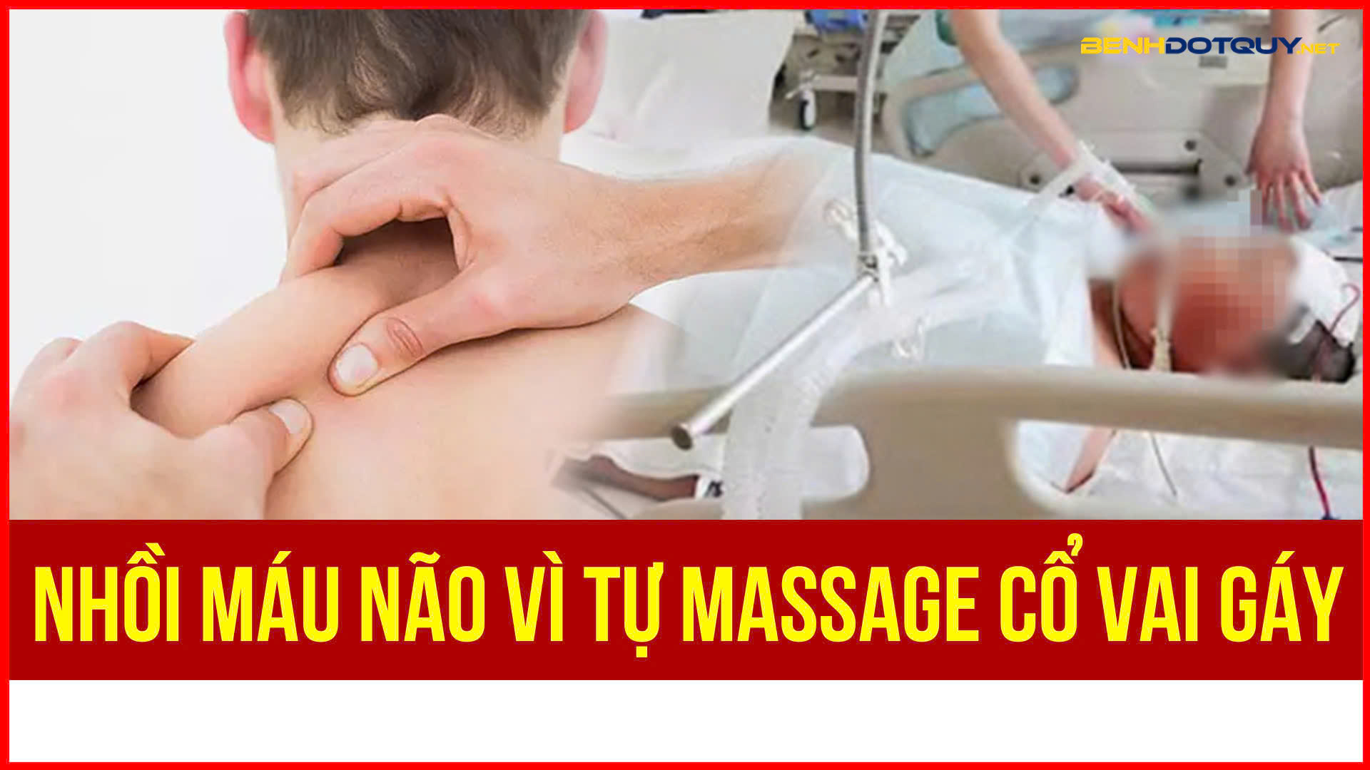 Người đàn ông bị nhồi máu não do tự massage cổ vai gáy