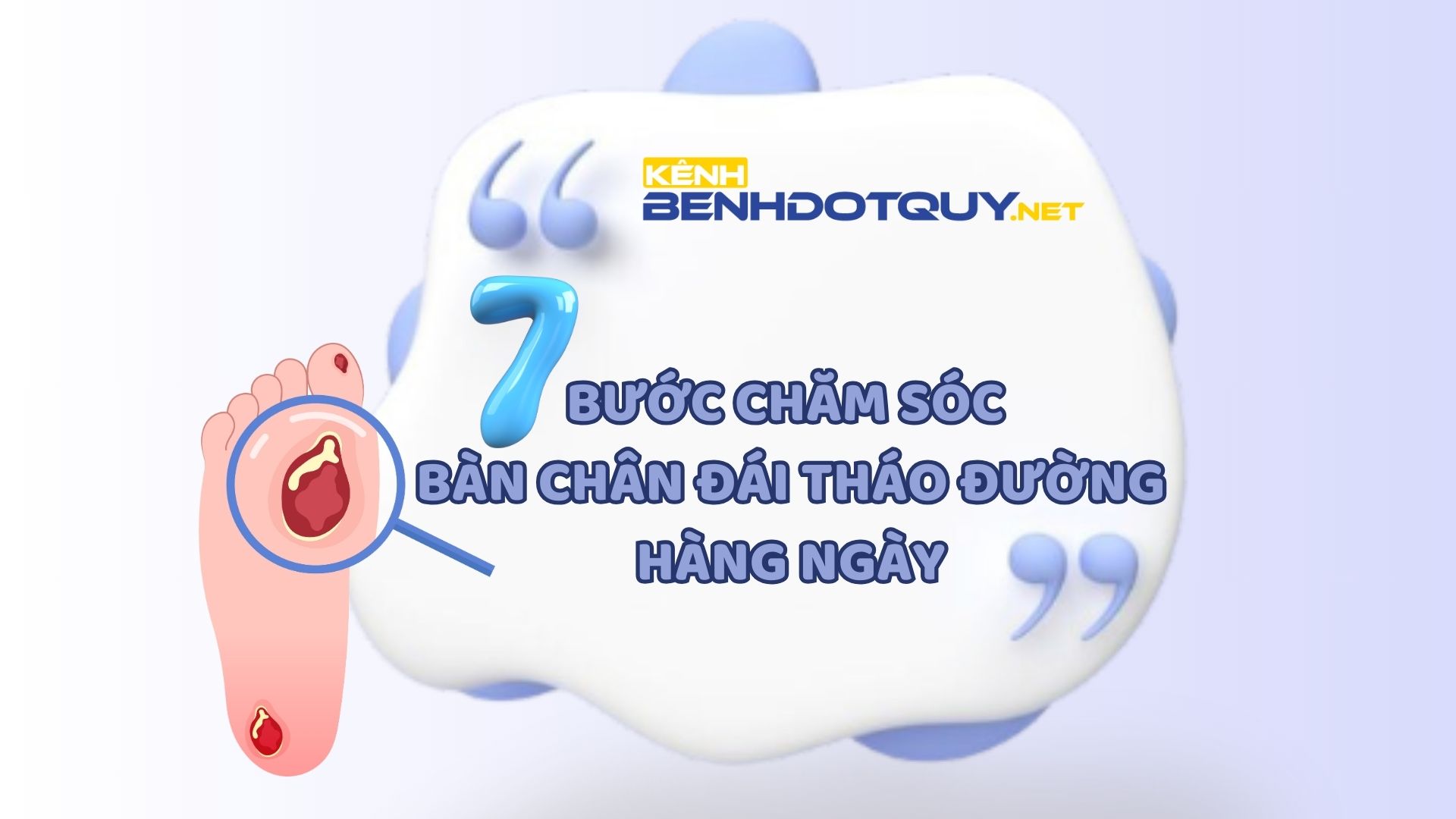 7 bước chăm sóc bàn chân đái tháo đường hàng ngày