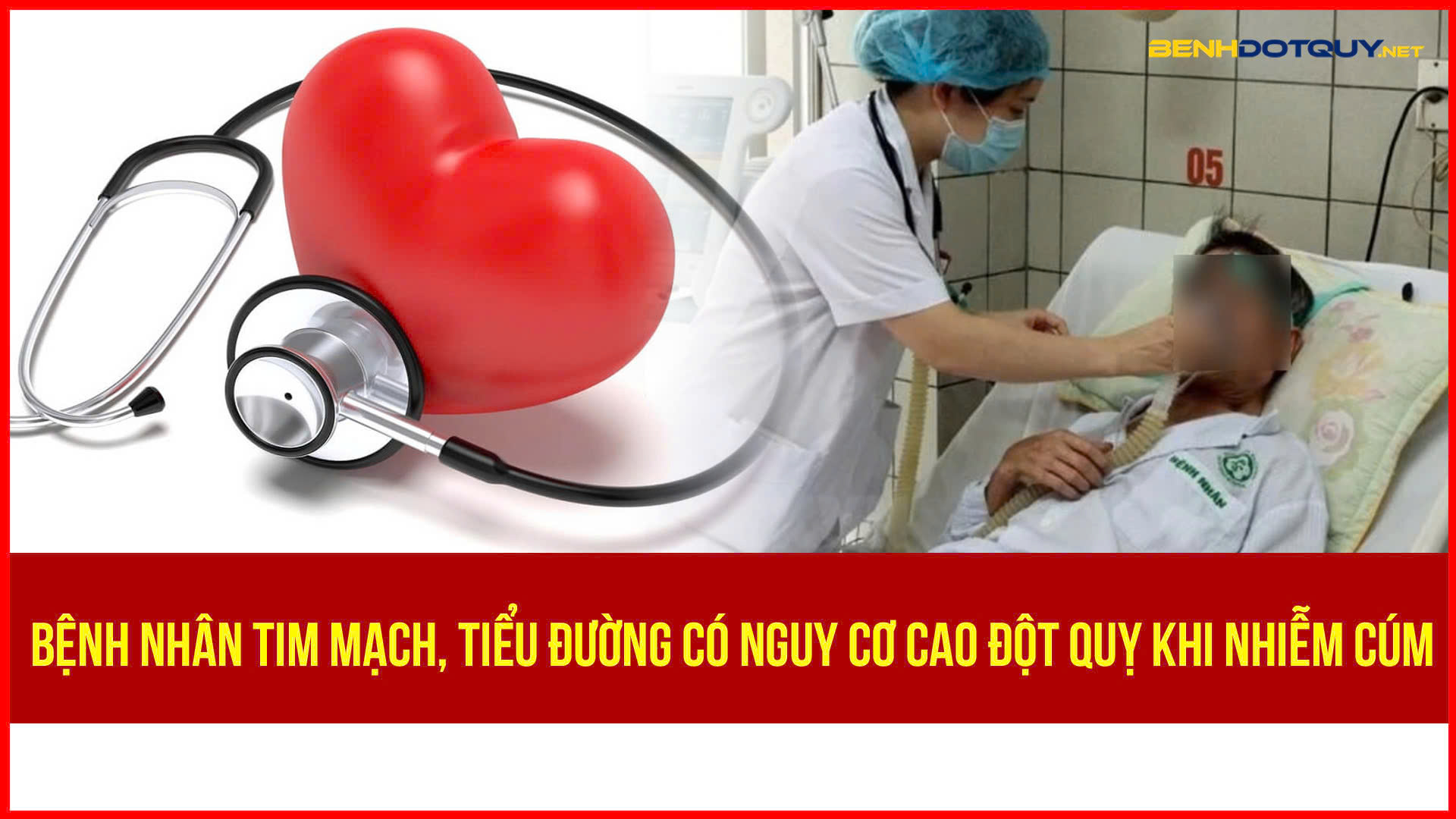 Nguy cơ đột quỵ tăng 3-10 lần ở bệnh nhân có bệnh lý nền mạn tính mắc cúm mùa